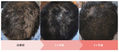 クリニックフォア治療症例写真