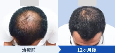 DMMオンラインクリニック治療症例写真