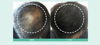 Dr.AGAクリニック治療症例写真