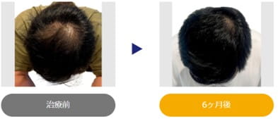 イースト駅前クリニック症例写真