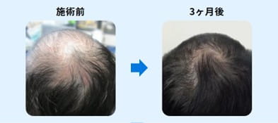 ゴリラクリニック症例写真