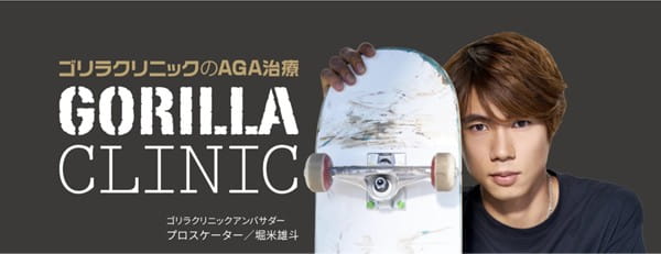 ゴリラクリニックのAGA治療