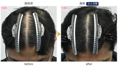 湘南AGAクリニック症例写真