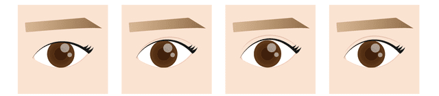 二重成型のデザイン